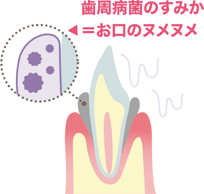 歯周病菌のすみか=お口のヌメヌメ